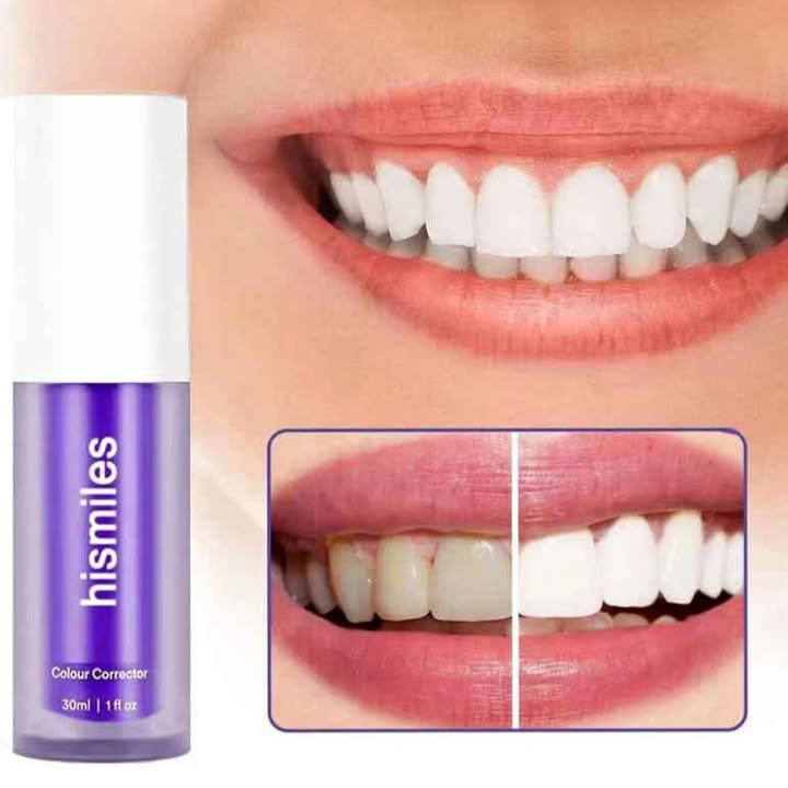 Hismile Blanchisseur de Dent - V34