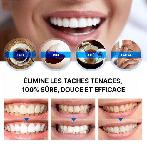 STYLO DE BLANCHIMENT DES DENTS